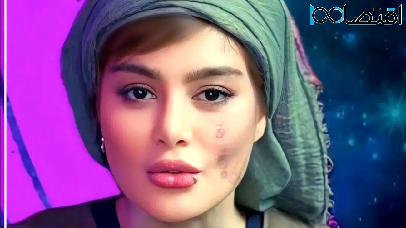 تغییر چهره خانم بازیگر از دبی تا آمریکا