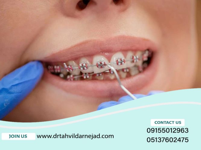 نکات کلیدی و توصیه‌های تخصصی